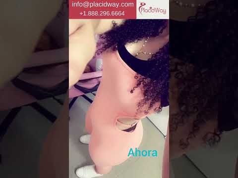 Mommy Makeover in Dominican Republic by Dr. Javier Baez MD