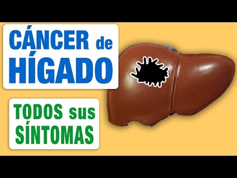 Sarcoma cancer canada