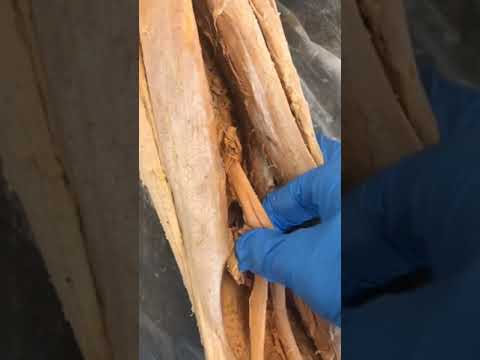 Your Hamstrings Are Hiding Something...