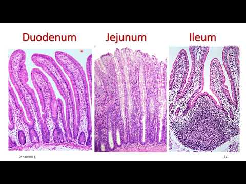 Histology of Duodenum, Jejunum & Ileum