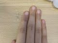 ABC Bebelê Unha