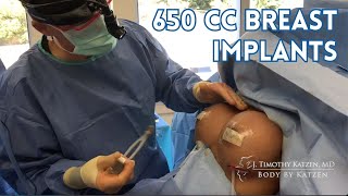 Breast Augmentation w/ Implants Teaser