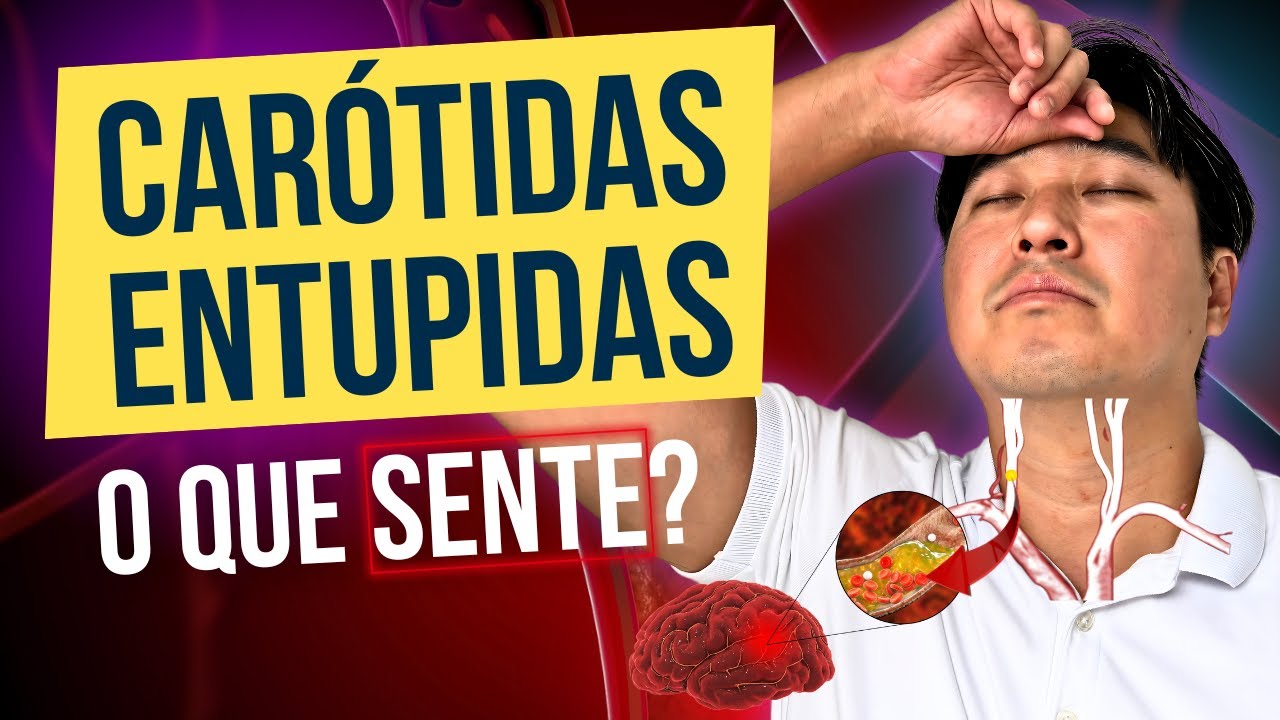 5 SINAIS DE ENTUPIMENTO DE CARÓTIDAS!
