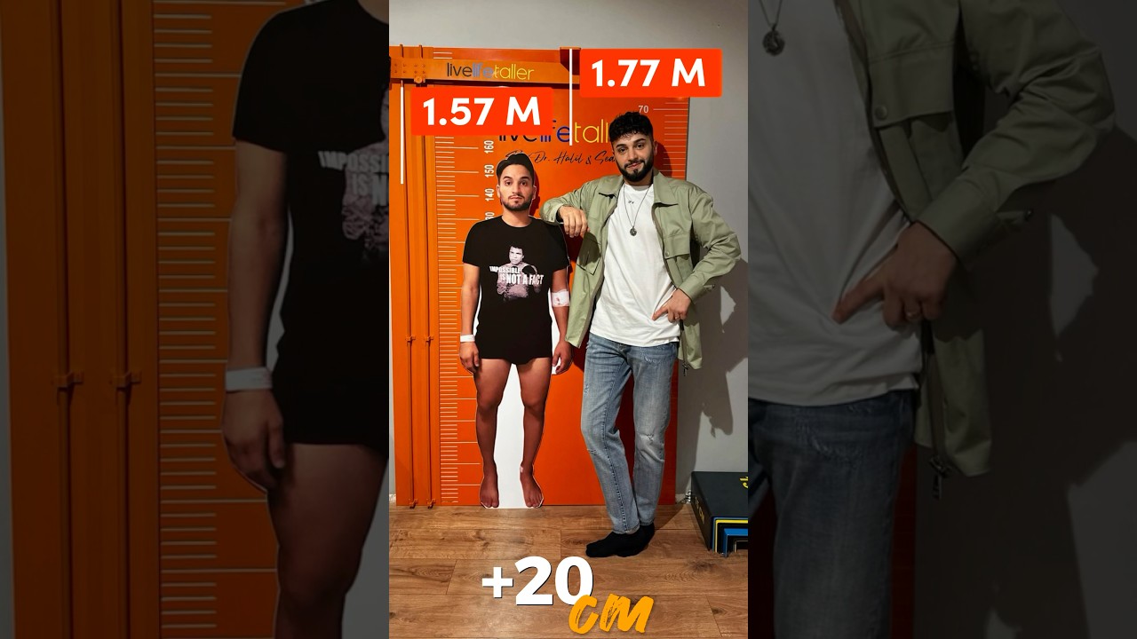 Sedat, the King of #limblengtheningsurgery gained worldwide fame. With a record extension of 20 cm