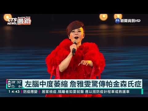 左腦中度萎縮 詹雅雯驚傳帕金森氏症