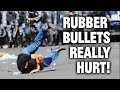 Ferguson Fallout: The Pain of Rubber Bullets 