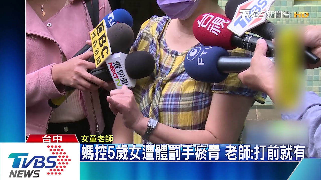 媽控5歲女遭體罰手瘀青 老師:打前就有