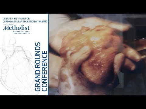 Two Decades of Thoracic Endovascular Aortic Repair (Himanshu J. Patel, MD) September 13, 2018