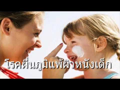 โรคสะเก็ดเงินผิวหนังเช่นการรักษา Seborrhea และโรคสะเก็ดเงินที่เป็น