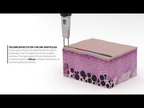 PICORE - PICO LASER REFINED