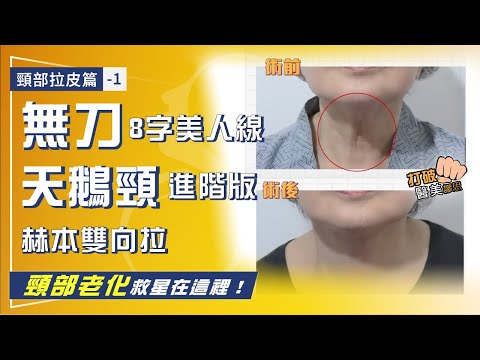 頸部拉皮篇-1｜頸部鬆弛、頸紋 打電波音波效果維持不久？ 脖子老化超強救星在這裡！無刀「8字美人線」 & 天鵝頸進階版「赫本頸闊雙向拉」