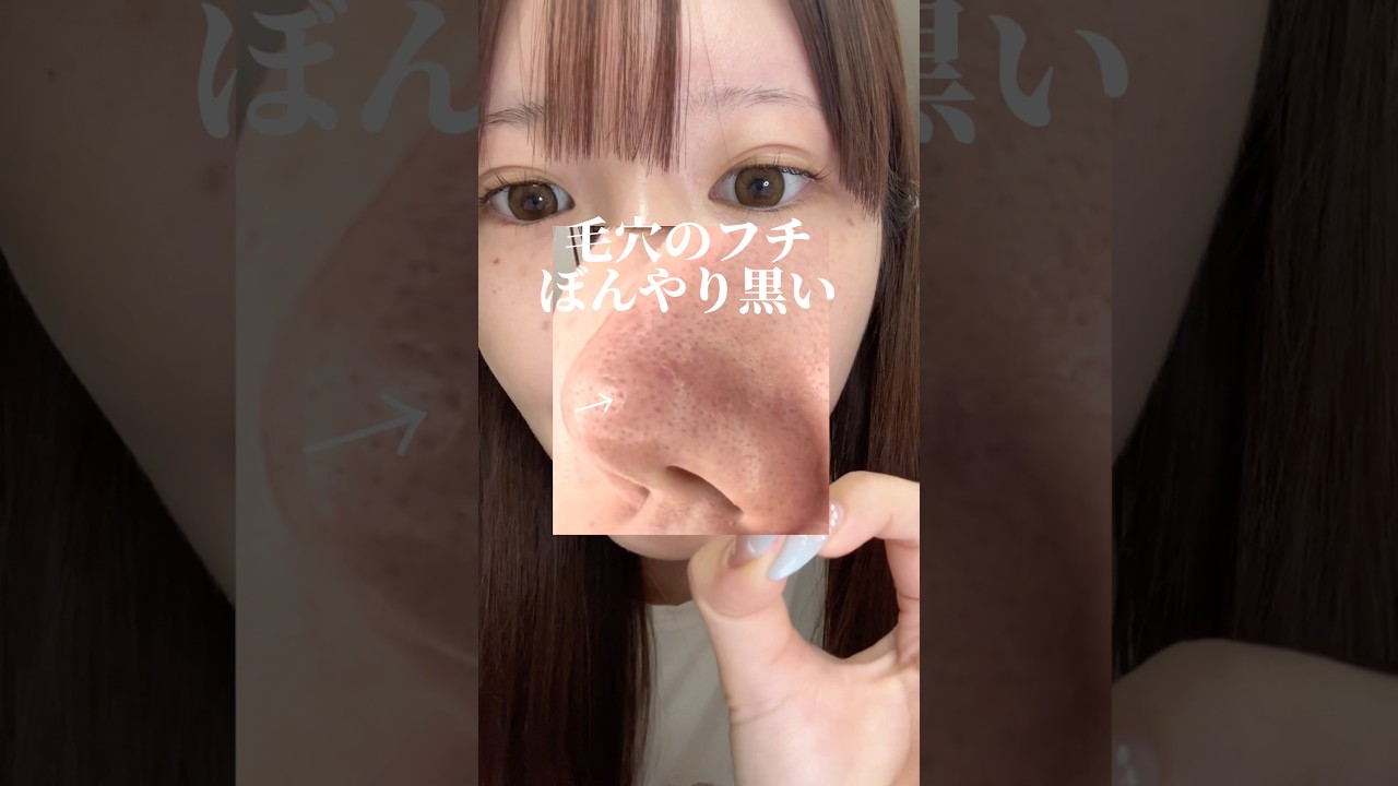 【消えない毛穴】もしかして''メラニン毛穴''説あるのか・・？