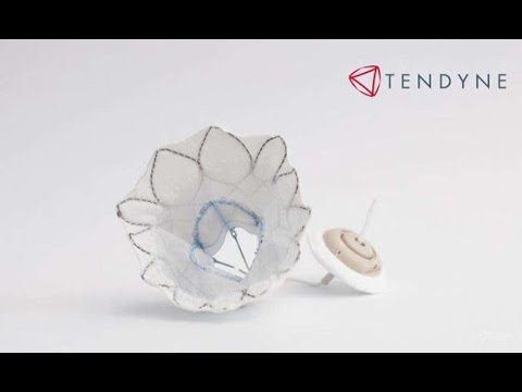 Experten fragen: Tendyne-Transkatheter-Mitralklappenersatz