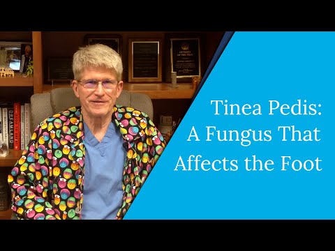 Tinea Pedis - The Fungus That Affects the Foot