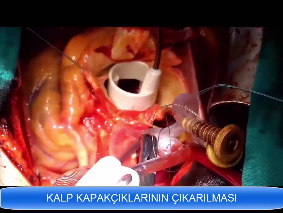 İlhan Gölbaşı-11