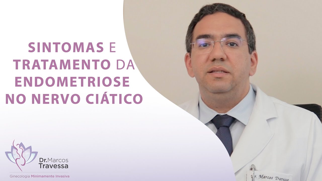 ENDOMETRIOSE no NERVO CIÁTICO: SINTOMAS e TRATAMENTO