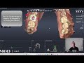 Pylon Free 3D Printed Surgical Guide Walkthrough