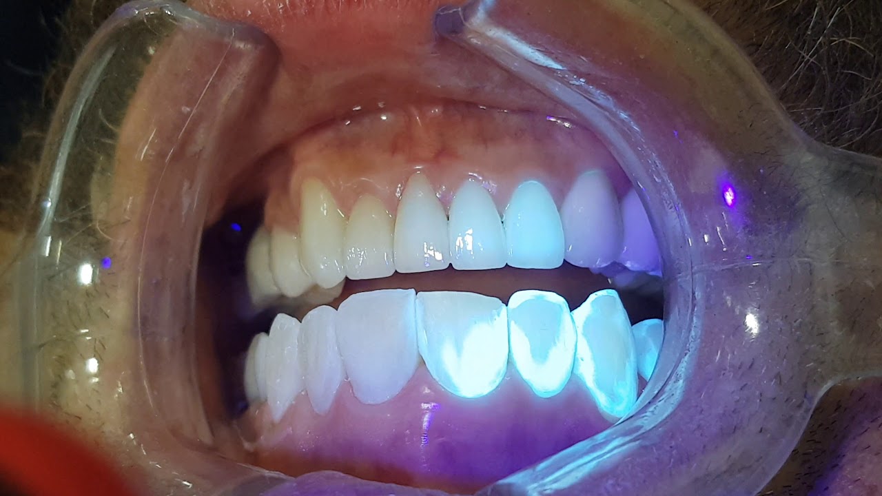 Alejandro Martinez-28