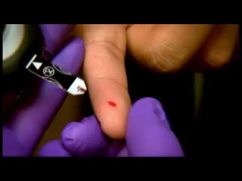 Gumuguhong nail treatment Halamang-singaw sa mga paa bilang isang paraan upang tratuhin ang mga lumang