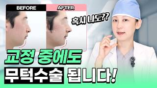 교정 중에도 가능했던 무턱수술, 20대 남성 리뷰 (옆모습 컴플렉스 극복!)