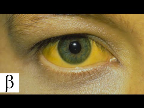 Top 7 enfermedades mas comunes SIN CURA  | Mike Beta tops