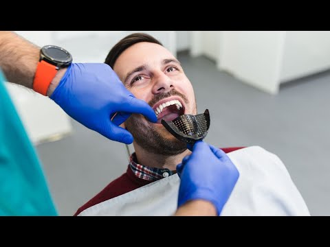 Professionelle Zahnaufhellung - Wie funktioniert sie und welche Methoden sind am effektivsten?