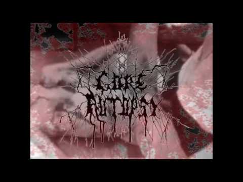 Gore Autopsy -  Dilacerated