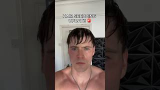 15 month hair shedding update! (finasteride +minoxidil) #hairloss #hairlosstreatment