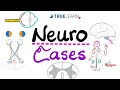 Neuro Cases With Answers TrueLearn Qbank Vignettes