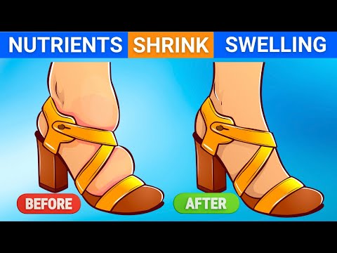 The 5 Nutrients That Can Shrink Your Swollen Feet & Legs