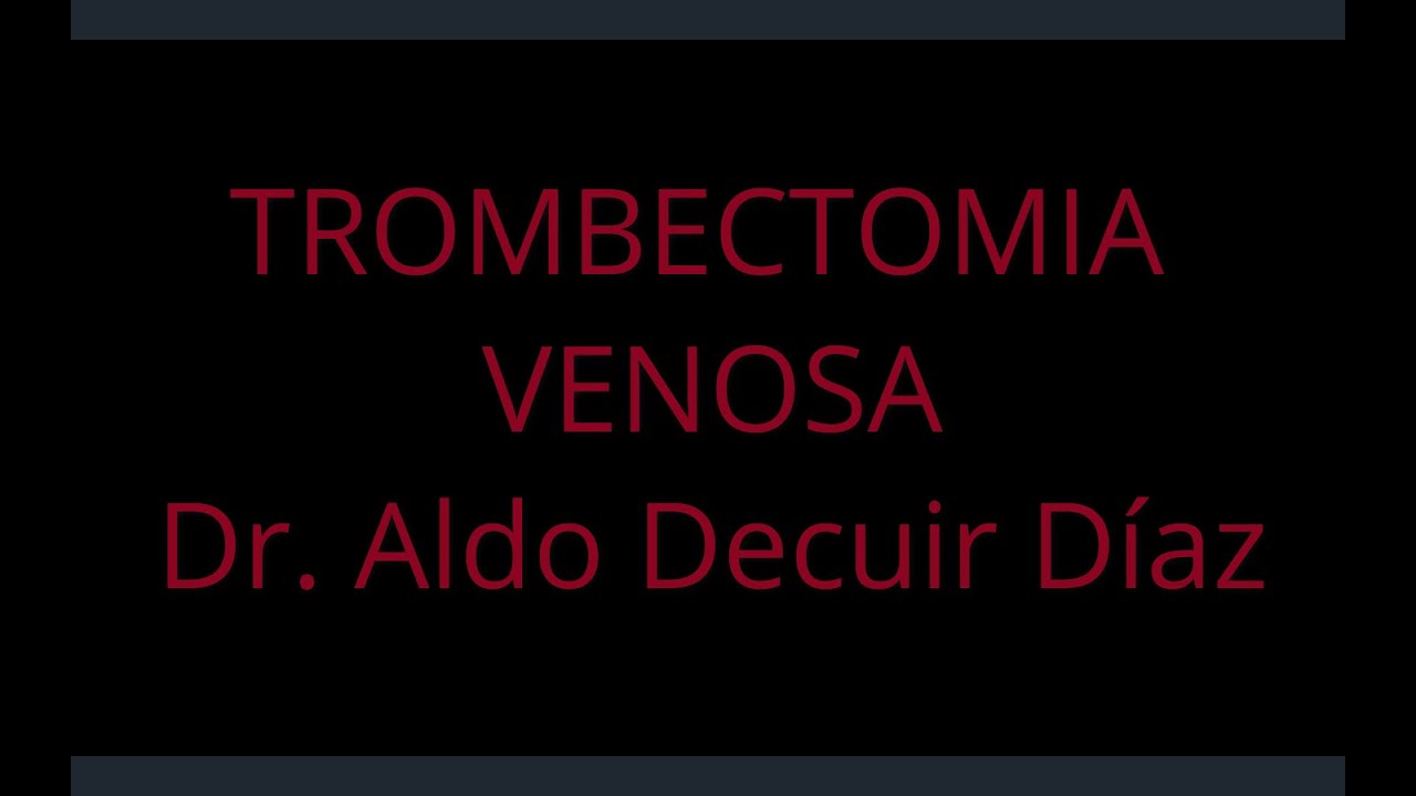 Aldo Decuir Díaz-170