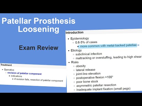 Patellar Prosthesis Loosening Exam Review - Matt Austin, MD