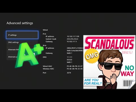 How to Change Xbox DNS Settings to Fix Lag, Errors & Connection Issues (2026 Guide)