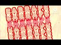 All I Want Is You Now But Extremely Earrape