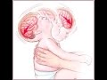 Shaken Baby Syndrome