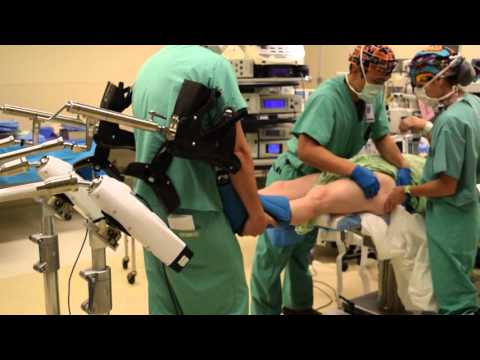 Tipi osteocondrosi di esacerbazioni Anca alfa norma angolo articolare