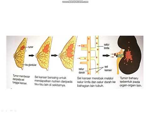 BIOLOGI TINGKATAN 4 : ISU PEMBAHAGIAN SEL