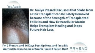 How to Clean Scabs from a Hair Transplant without Fear of Losing Grafts & Stopping Future Hair Loss