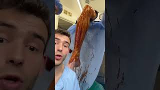 Download lagu I've never worked in an operating room #shorts mp3 Download lagu I've never worked in an operating room #shorts mp3