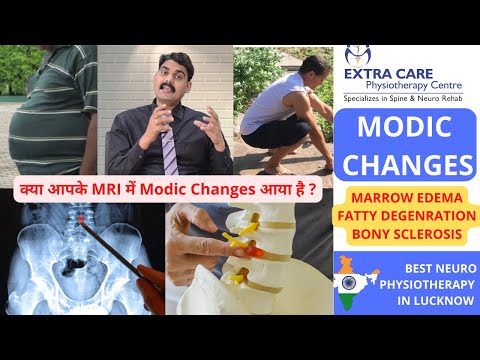 MODIC CHANGES in Lower BACK | Lumbar Spine MRI | Disc Degeneration & Endplate Changes