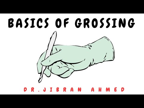 PANCREATITIS II PANCREAS II ROBBINS II PATHOLOGY