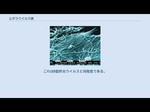 研究室からのウイルス:エボラ出血熱のような病原体は3日以内に死滅する