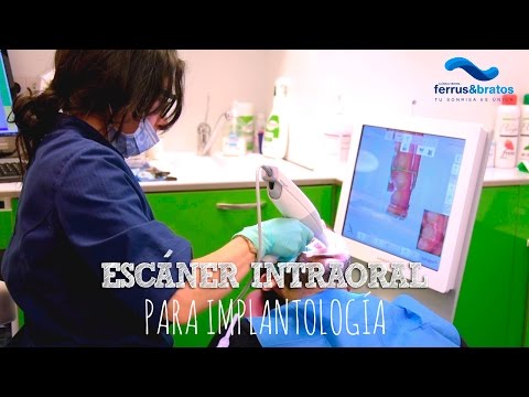 Escáner intraoral para implantología