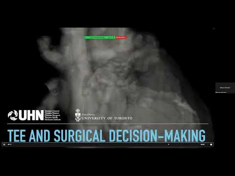 TGH APTE - TEE and Surgical Decision Making, Dr. Marcus Salvatori