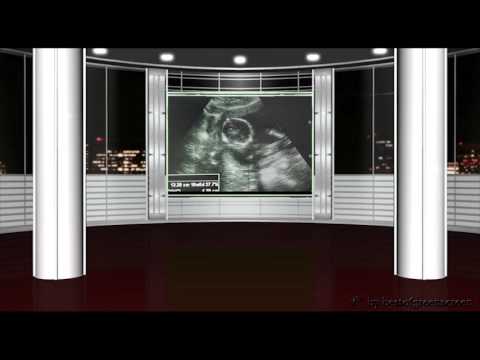 WODU-IL SUO NOME È LEGGENDA-PROD.LUIS RODRIGUEZ