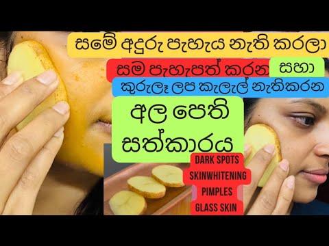 I Rub potato🥔slice on face & removed Dark spots |Pimples කුරුලෑ ලප කැලැල් නැති කරන අර්තාපල් සත්කාරය