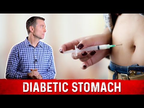 Can Diabetes Be Reversed – Dr Berg