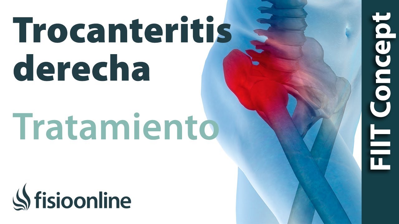 Tratamiento de la trocanteritis derecha