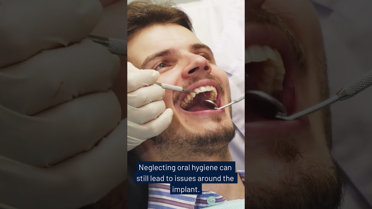 How Do I Care for My Dental Implants Once They Are Placed?