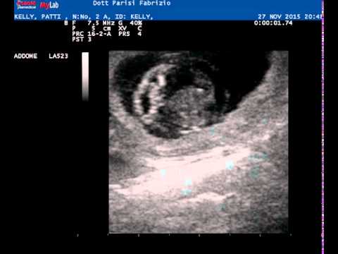 adenoma prostatico cane adenoma prostatico cane